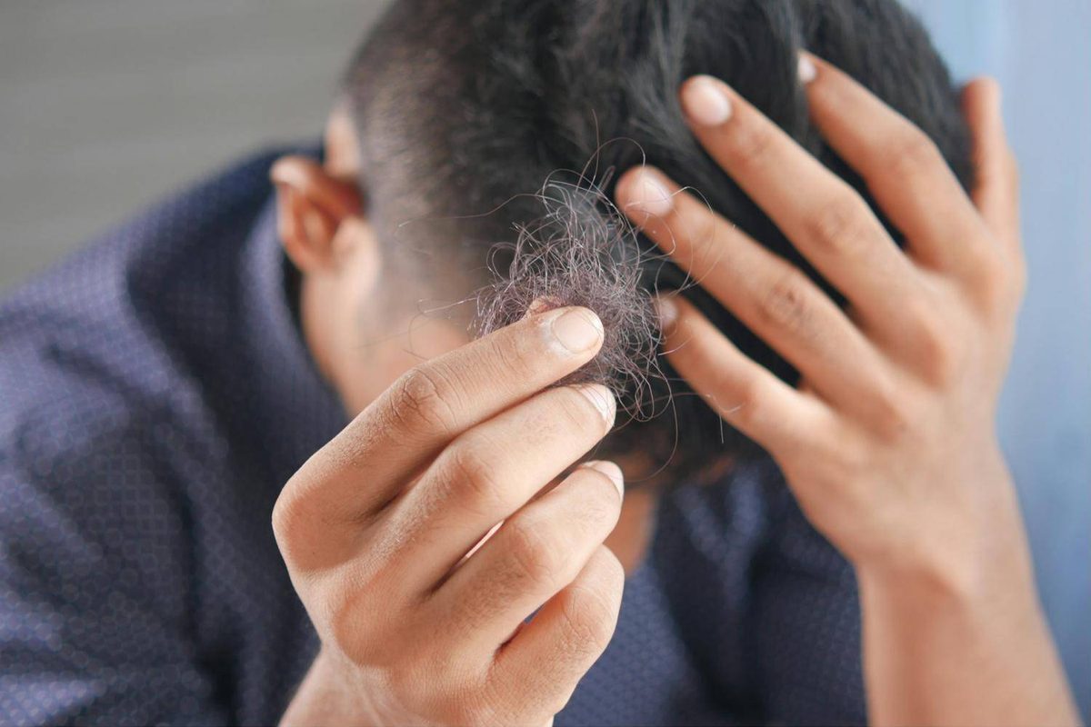 Persona sujetando cabello caído